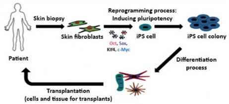 induced pluripotent stem cells
